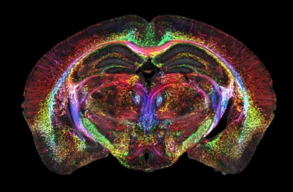 اسکن هایی که 64 میلیون بار واضح تر هستند، بینش جدیدی از مغز به ما می دهند