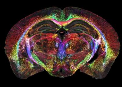 اسکن هایی که 64 میلیون بار واضح تر هستند، بینش جدیدی از مغز به ما می دهند